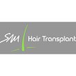 sm-hair-transplant